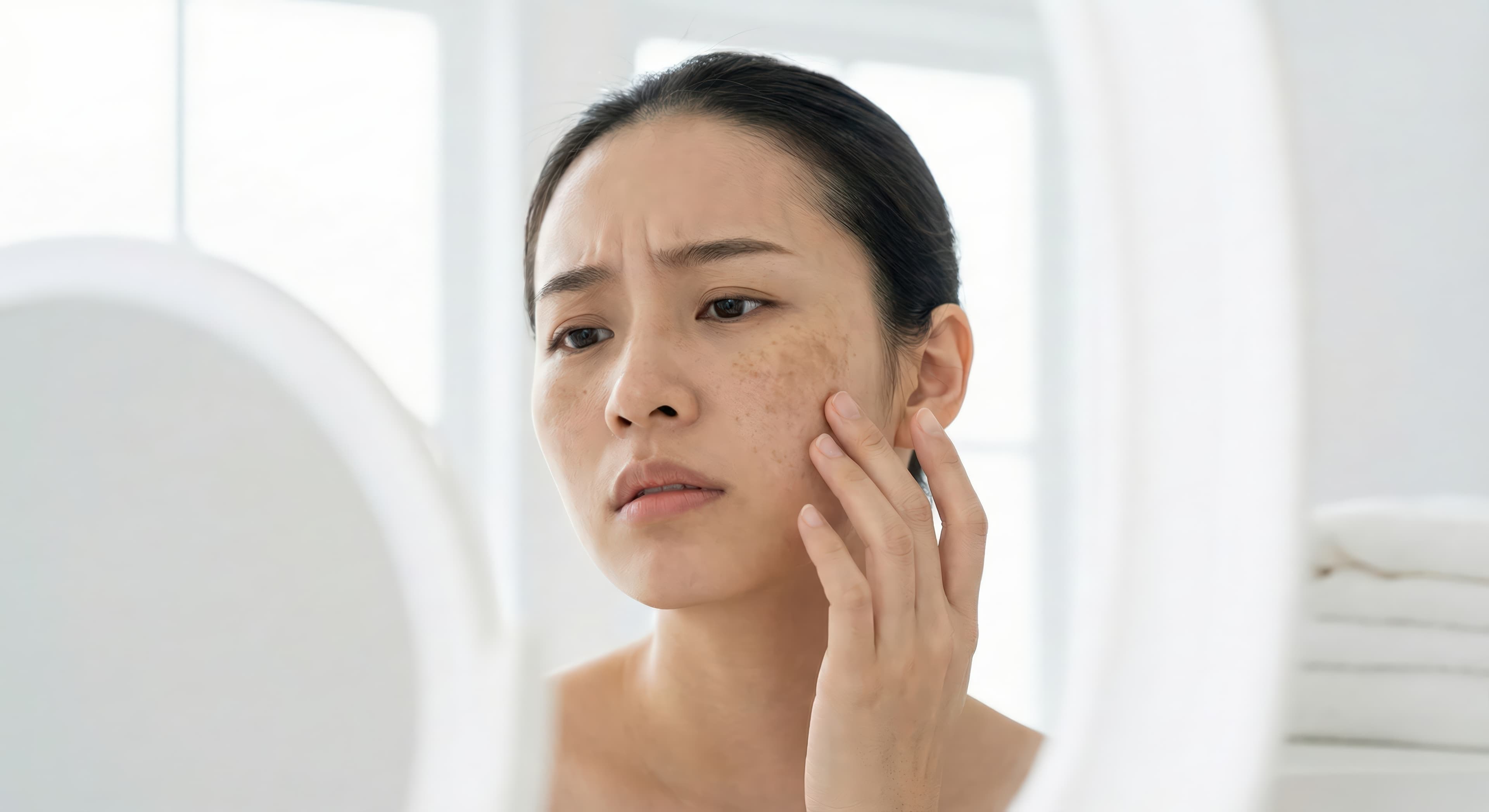 Close-up of skin with dark spots and uneven tone being assessed before treatment.