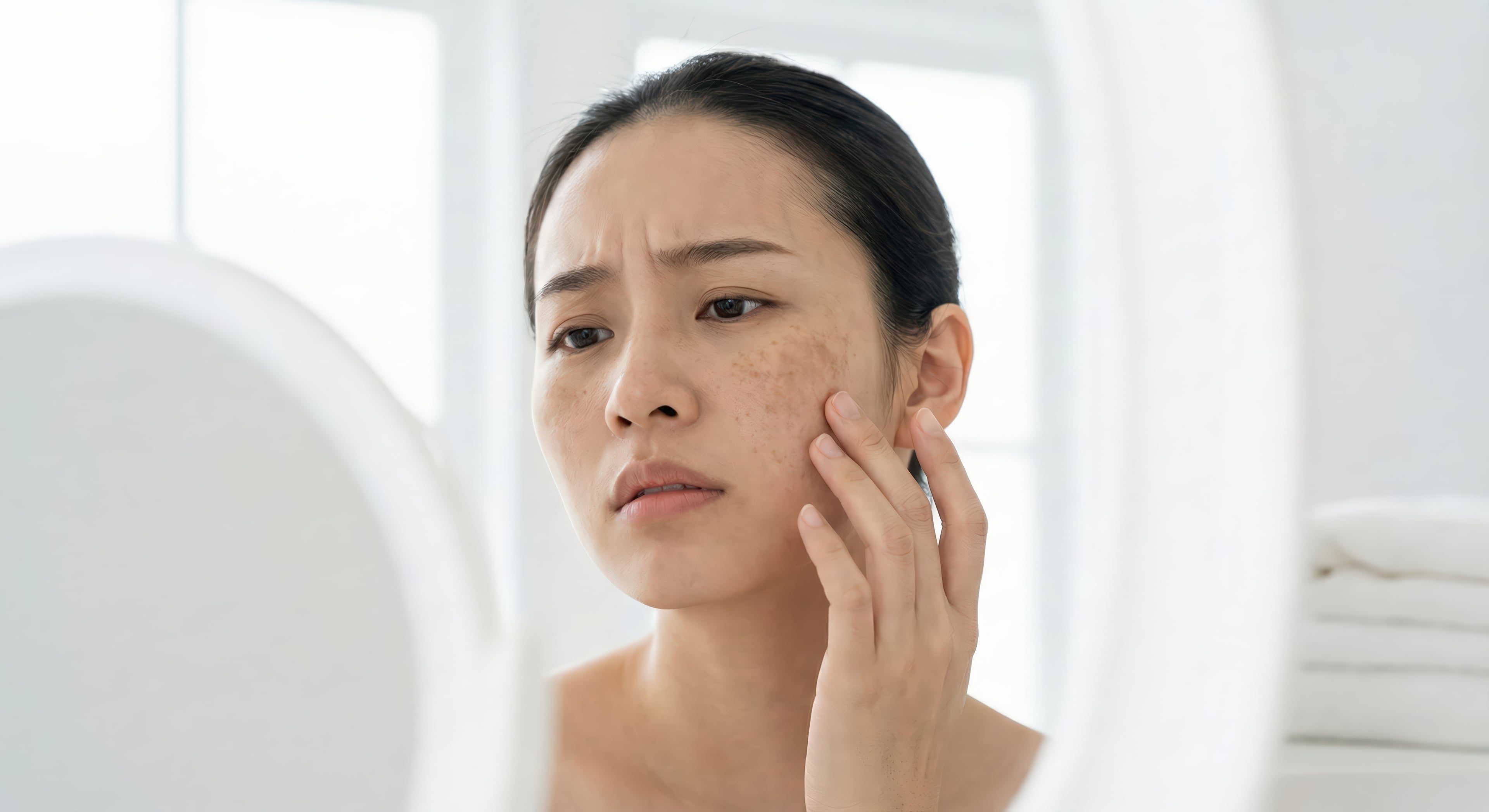 Close-up of skin with dark spots and uneven tone being assessed before treatment.